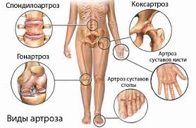 суставы 8
